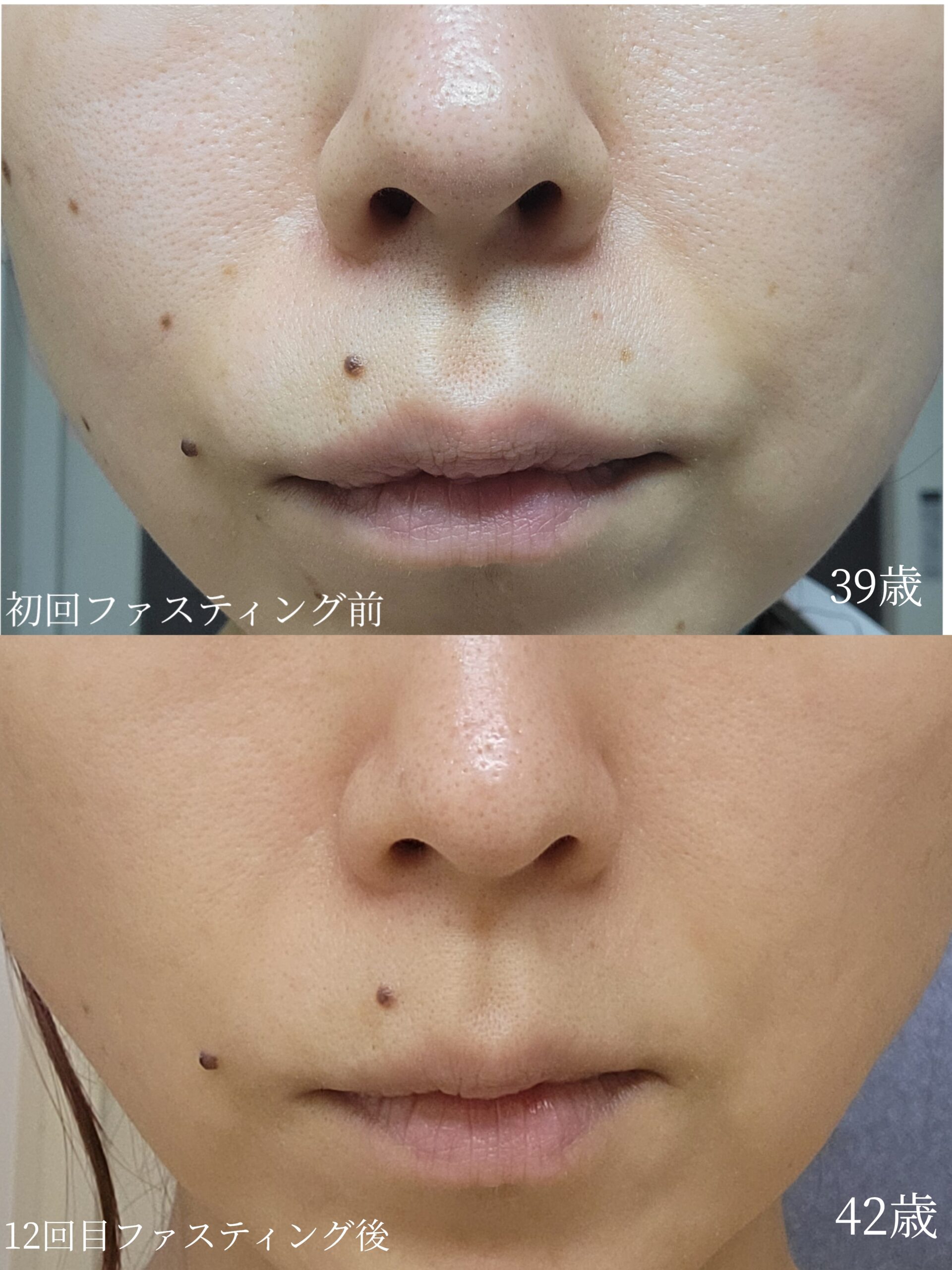 ☆若返りたいならこれがおススメ☆白金台・爪を育てるネイルサロンリヒロ☆
