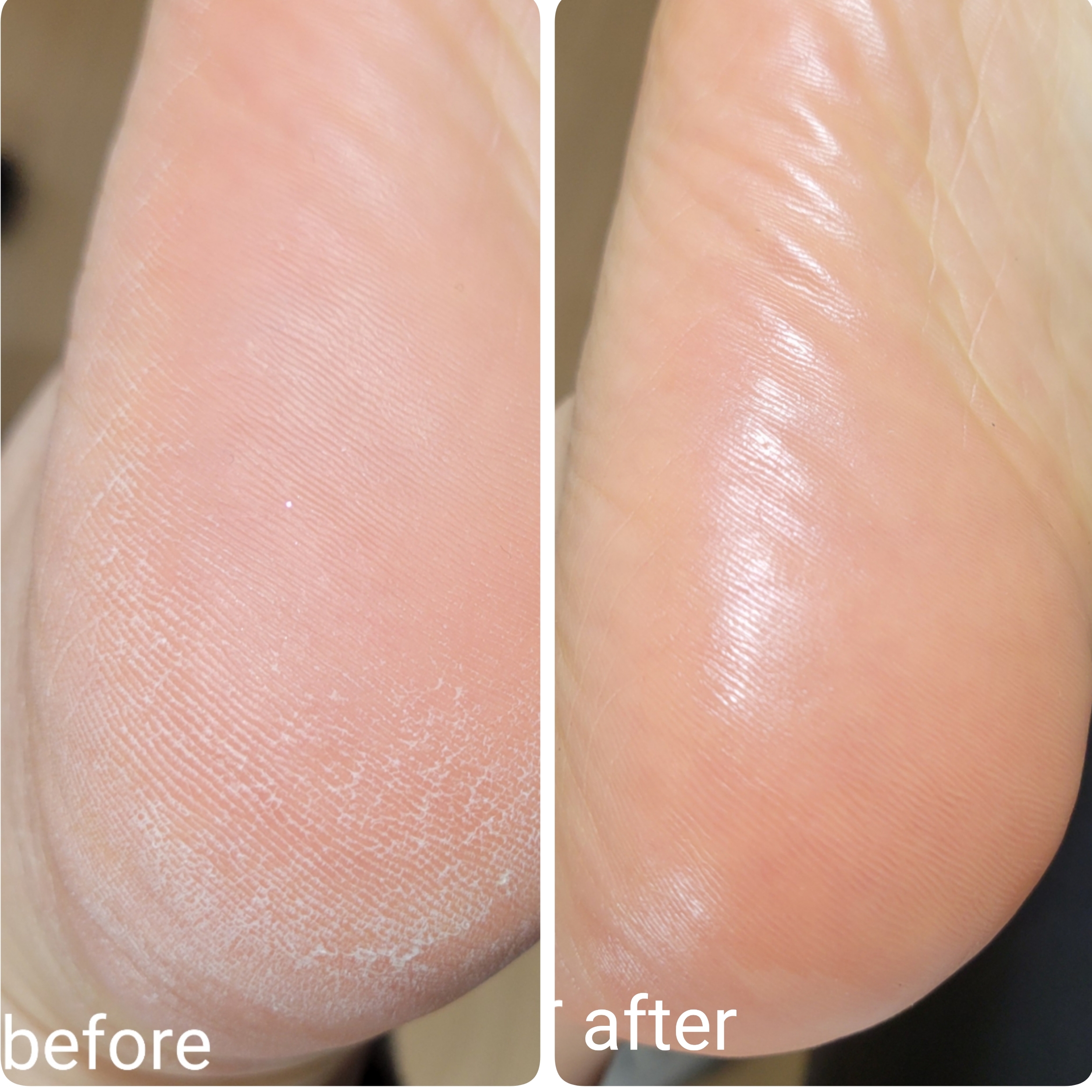 ☆つるつるな足裏が欲しいあなたへ☆白金台・爪を育てるネイルサロンリヒロ☆